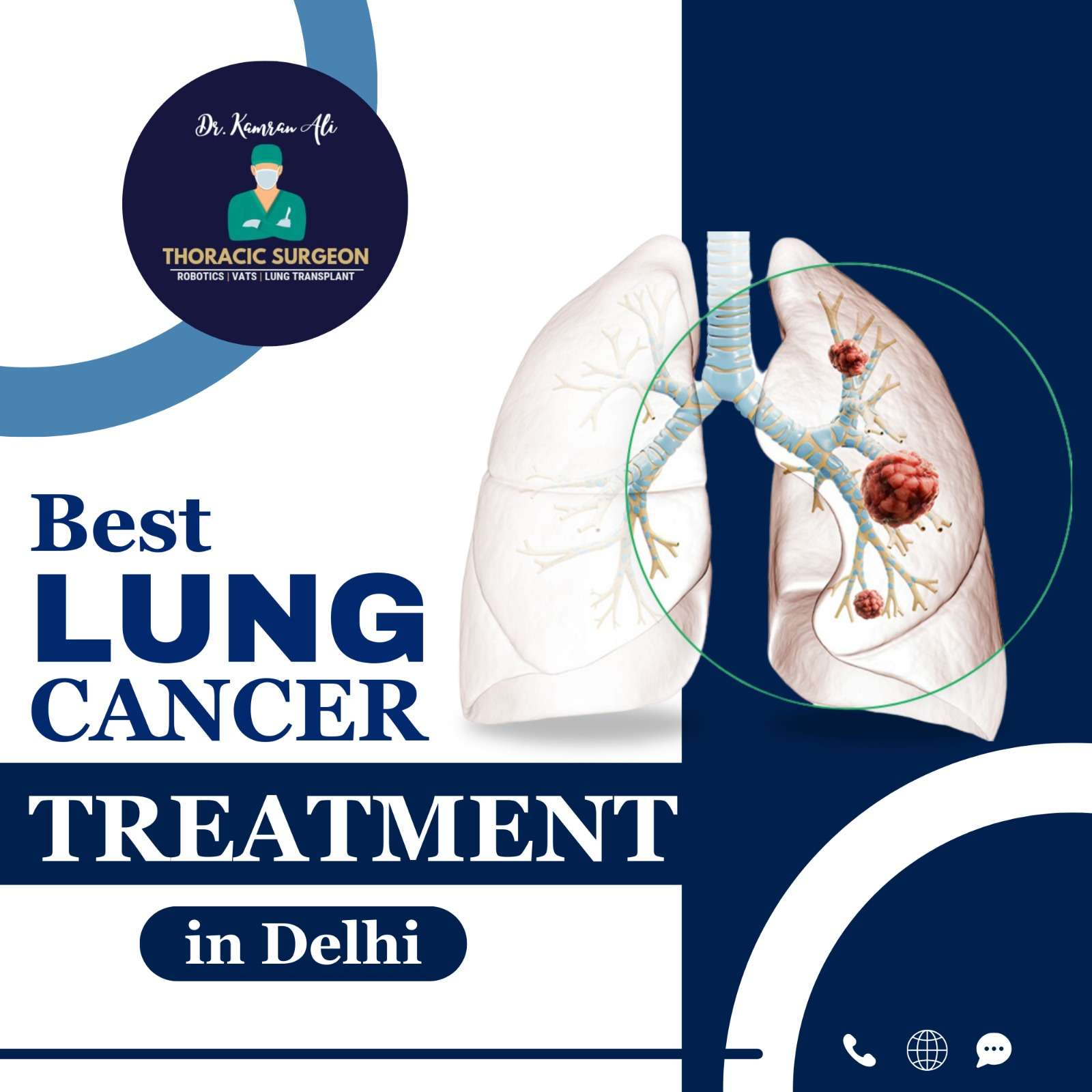 Best Lung Cancer Treatment in Delhi | Dr. Kamran Ali